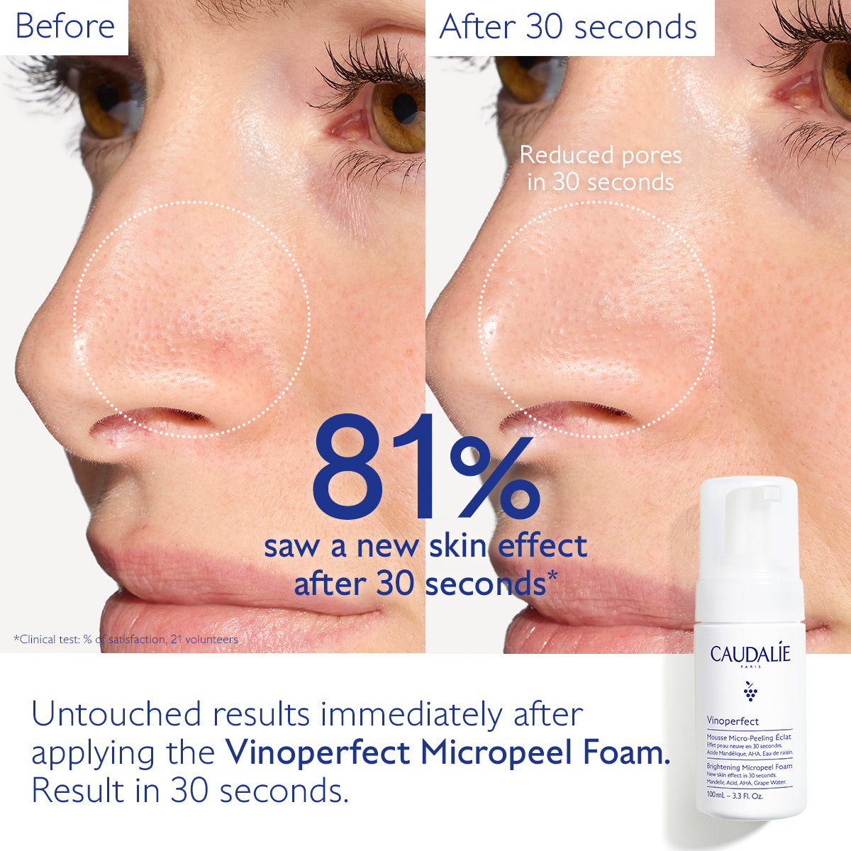 Caudalie Vinoperfect Brightening Micropeel Foam
