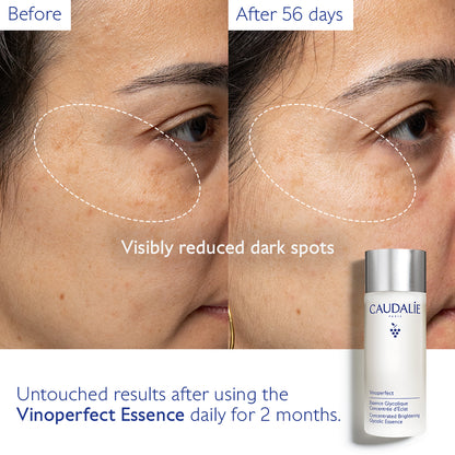 Caudalie Vinoperfect Concentrated Glycolic Essence
